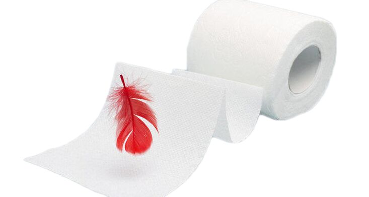 Hemorrhoids - an extremely common disease